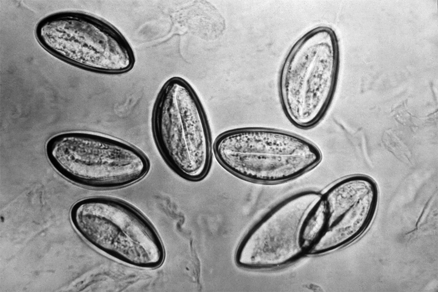 Enterobius_vermicularis