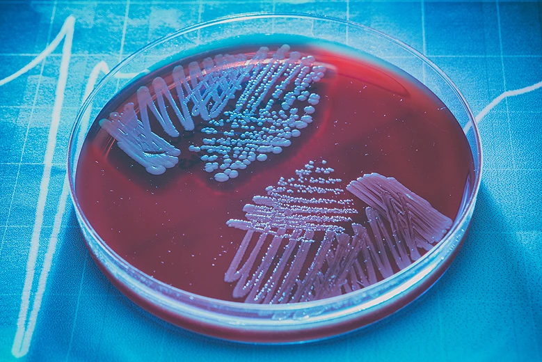 muestra_cell